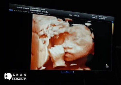 毓婷测的快还是大卫快？怀孕后的症状都有哪些？