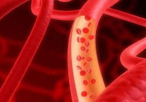 子宫全切后45天有少量出血，多久能好？